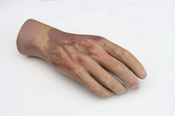 Machado Hybrid Hand